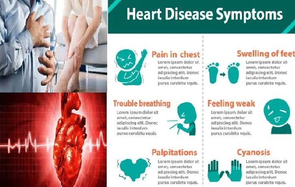 What are the Symptoms of Heart Disease?