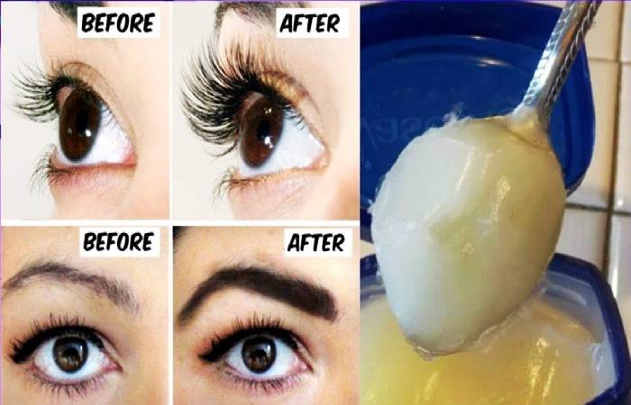 What is Petroleum Jelly? – Benefits, Uses, Side Effects, and More
