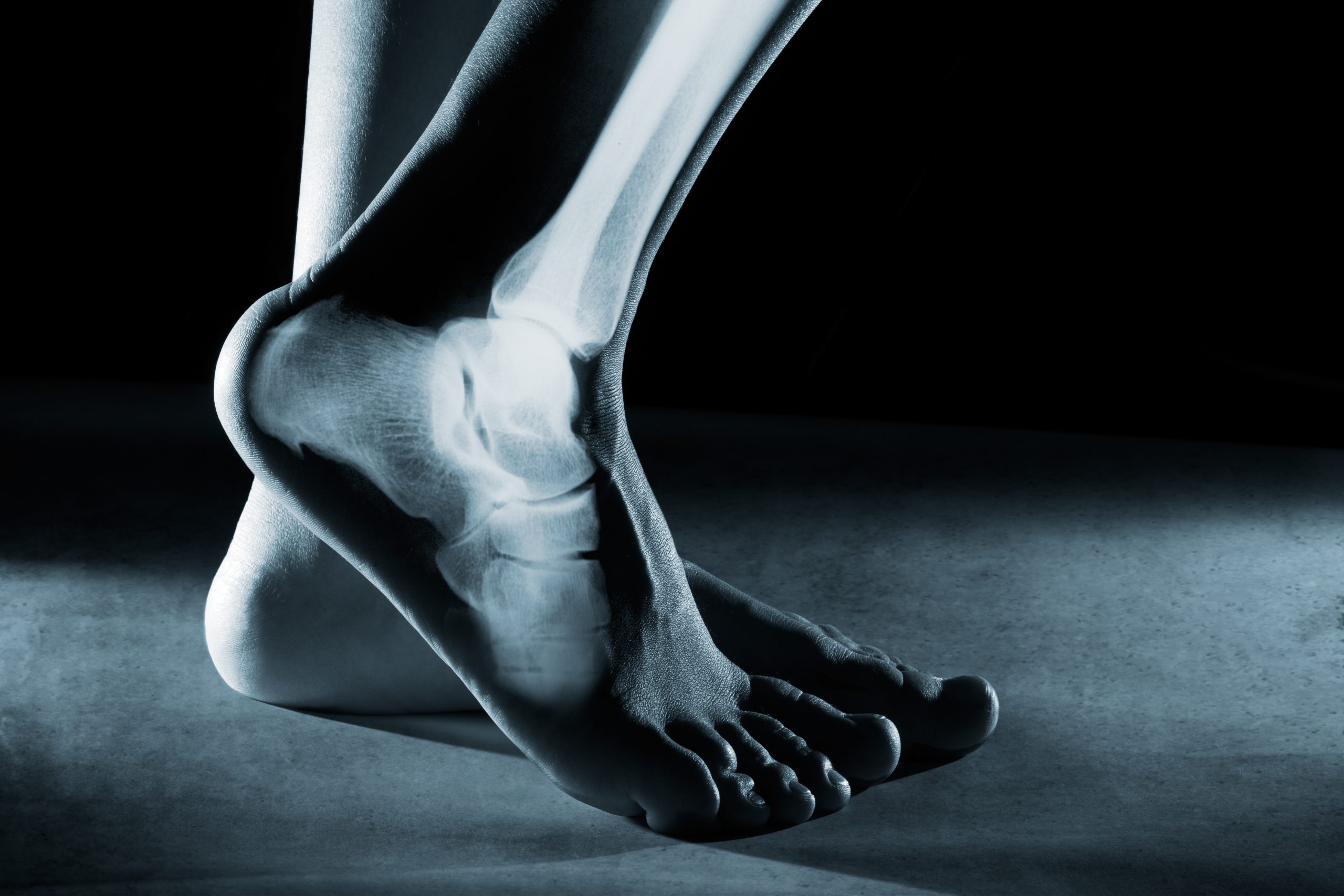 Human foot ankle and leg in x-ray