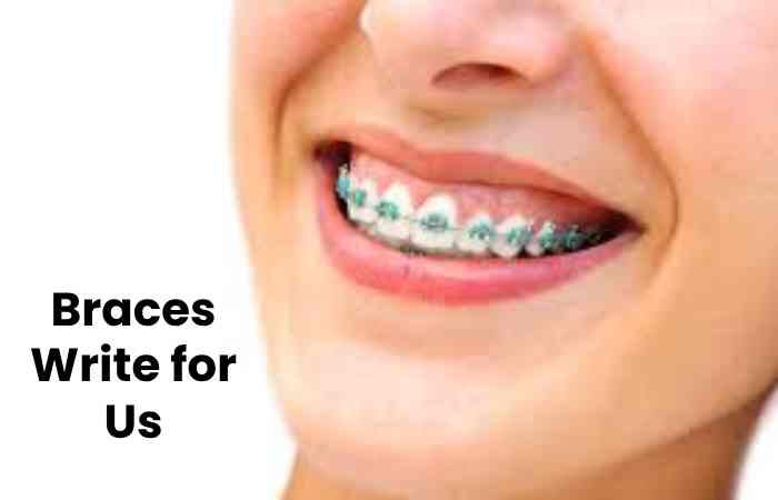 Braces Write for Us